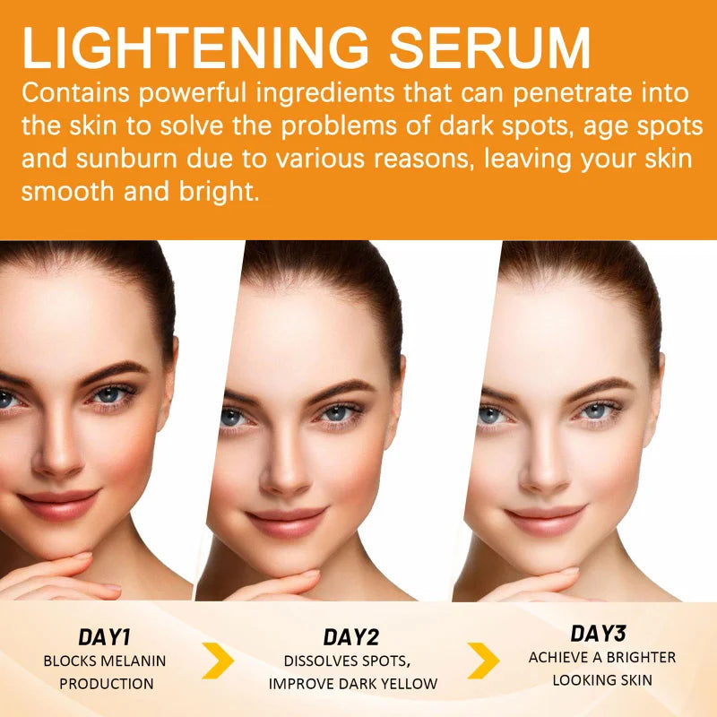 Facial Dark Spot Remover Serum